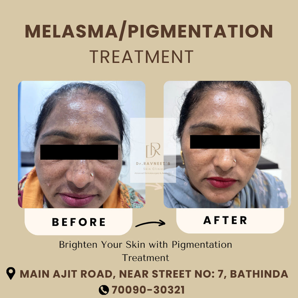 Treatment Result